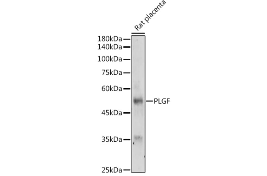 Western Blot - Anti-PLGF Antibody (A89089) - Antibodies.com