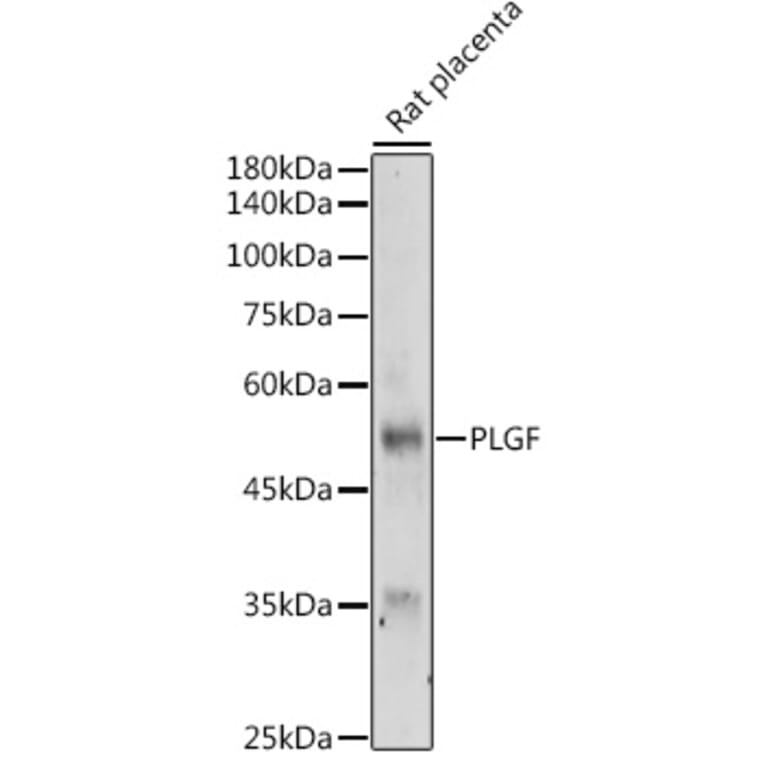 Western Blot - Anti-PLGF Antibody (A89089) - Antibodies.com