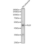 Western Blot - Anti-PLGF Antibody (A89089) - Antibodies.com