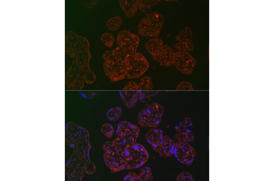 Immunofluorescence - Anti-PLGF Antibody (A89089) - Antibodies.com