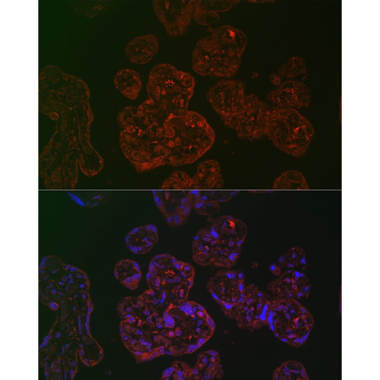 Immunofluorescence - Anti-PLGF Antibody (A89089) - Antibodies.com