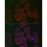 Immunofluorescence - Anti-PLGF Antibody (A89089) - Antibodies.com