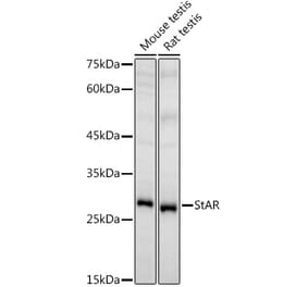 Western Blot - Anti-StAR Antibody (A89090) - Antibodies.com