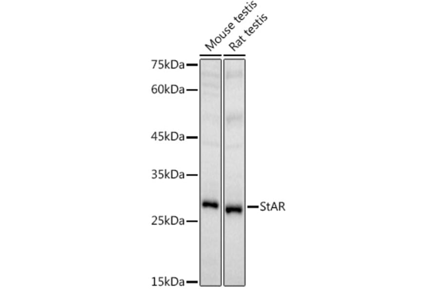 Western Blot - Anti-StAR Antibody (A89090) - Antibodies.com