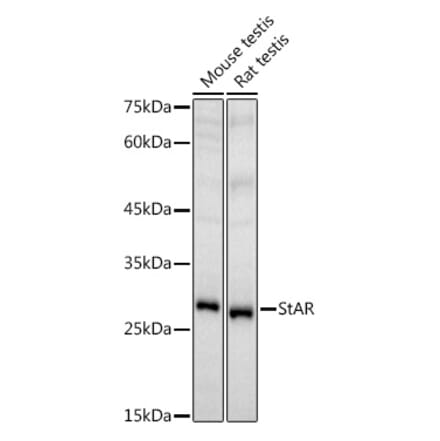Western Blot - Anti-StAR Antibody (A89090) - Antibodies.com