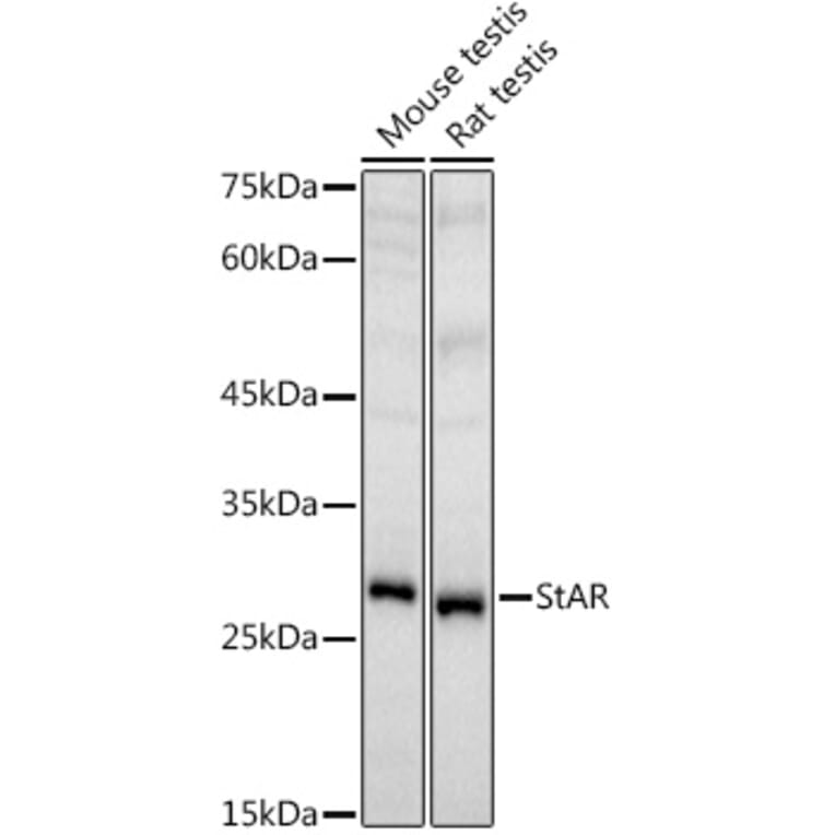 Western Blot - Anti-StAR Antibody (A89090) - Antibodies.com