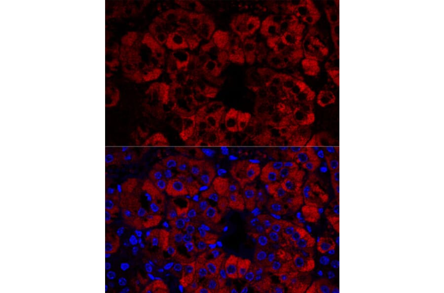 Immunofluorescence - Anti-StAR Antibody (A89090) - Antibodies.com