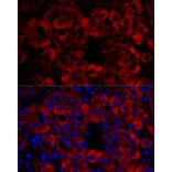 Immunofluorescence - Anti-StAR Antibody (A89090) - Antibodies.com