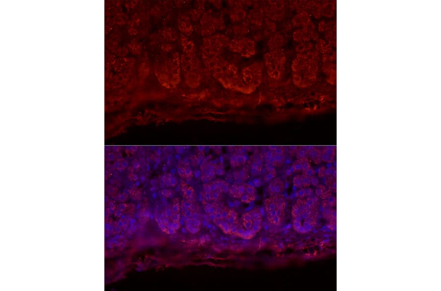 Immunofluorescence - Anti-StAR Antibody (A89090) - Antibodies.com