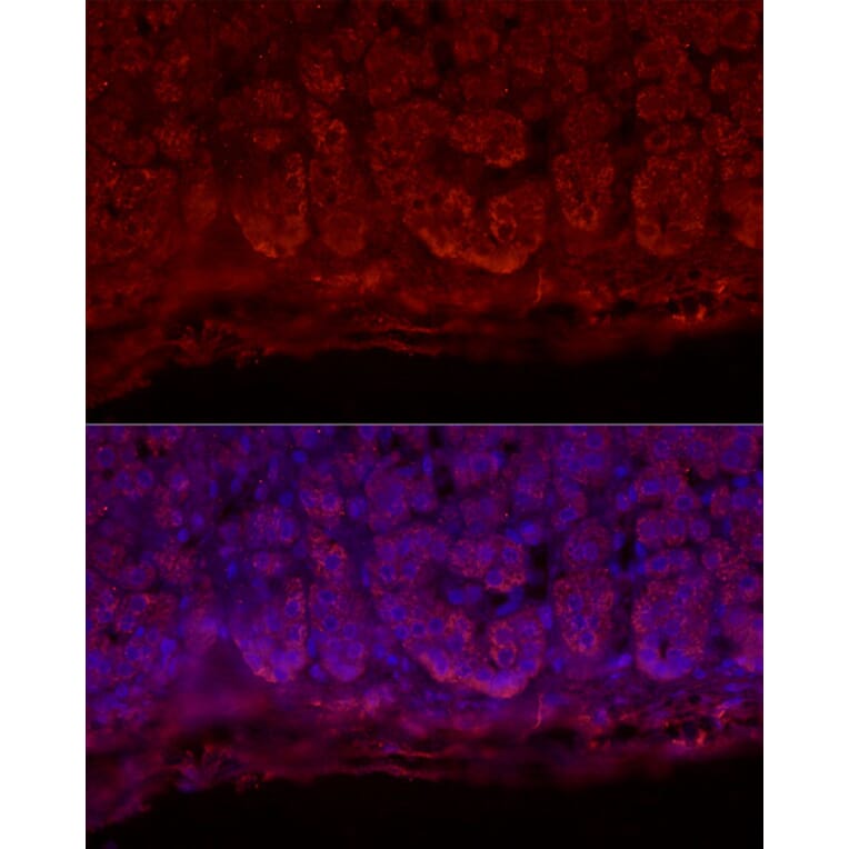Immunofluorescence - Anti-StAR Antibody (A89090) - Antibodies.com