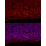 Immunofluorescence - Anti-StAR Antibody (A89090) - Antibodies.com
