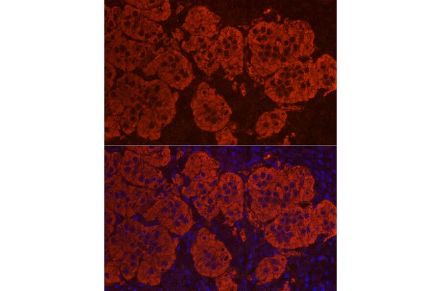 Immunofluorescence - Anti-StAR Antibody (A89090) - Antibodies.com