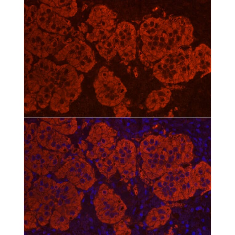 Immunofluorescence - Anti-StAR Antibody (A89090) - Antibodies.com