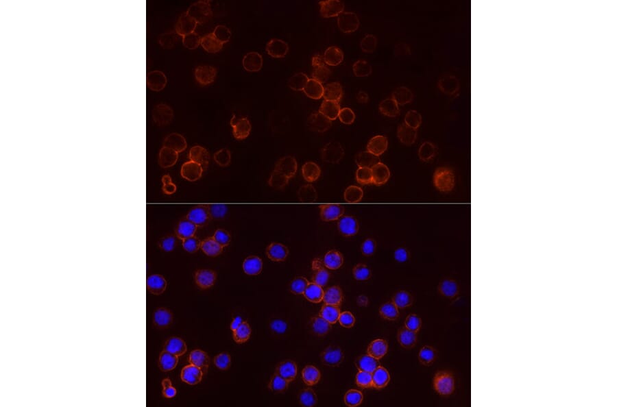 Immunofluorescence - Anti-StAR Antibody (A89090) - Antibodies.com