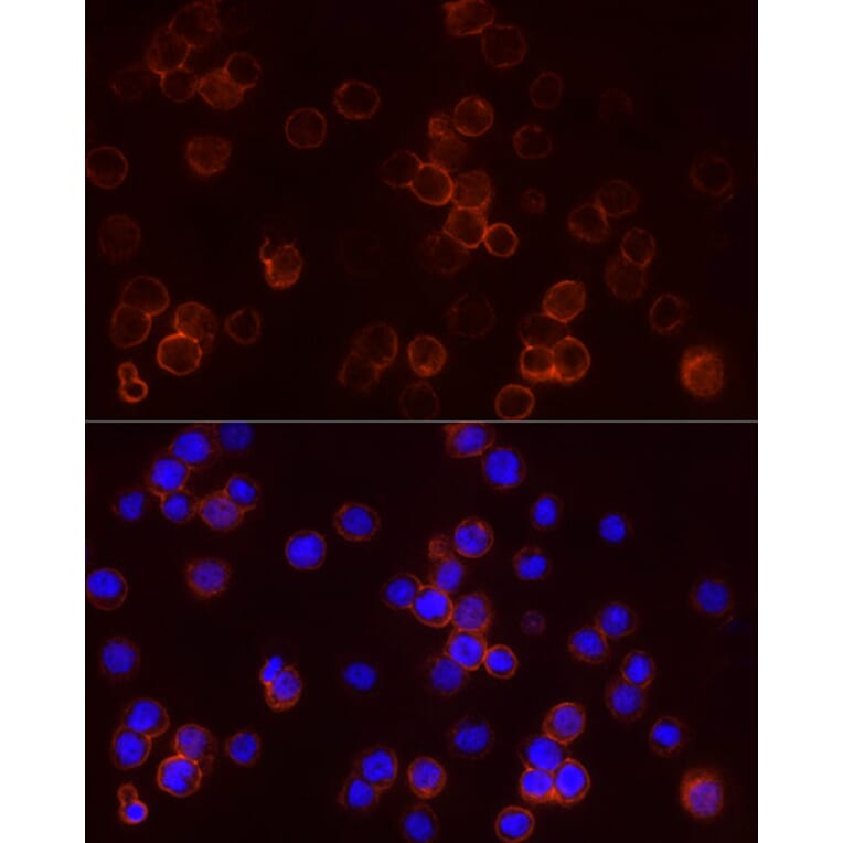 Immunofluorescence - Anti-StAR Antibody (A89090) - Antibodies.com