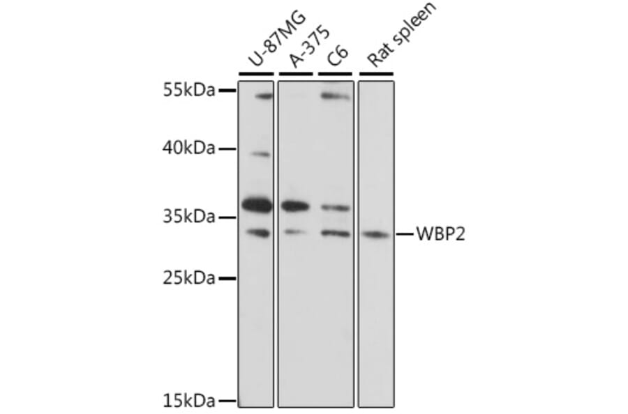 Western Blot - Anti-WBP2 Antibody (A89091) - Antibodies.com