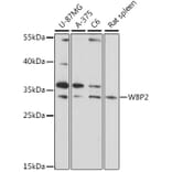 Western Blot - Anti-WBP2 Antibody (A89091) - Antibodies.com