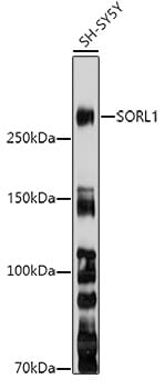 Western blot analysis of extracts of various cell lines, using Anti-SORL1 Antibody (A13047) at 1:3000 dilution.
Secondary antibody: Goat Anti-Rabbit IgG (H+L) (HRP) (AS014) at 1:10,000 dilution.
Lysates / proteins: 25µg per lane.
Blocking buffer: 3% non-fat dry milk in TBST.
Detection: ECL Enhanced Kit (RM00021).
Exposure time: 90s.