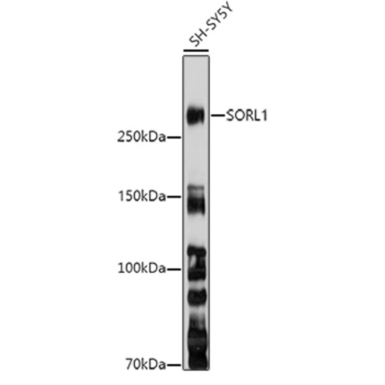 Western Blot - Anti-SorLA/SORL1 Antibody (A89092) - Antibodies.com