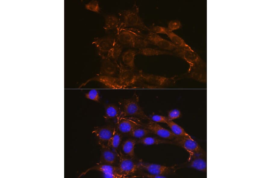 Immunofluorescence - Anti-Fibronectin Antibody (A89093) - Antibodies.com