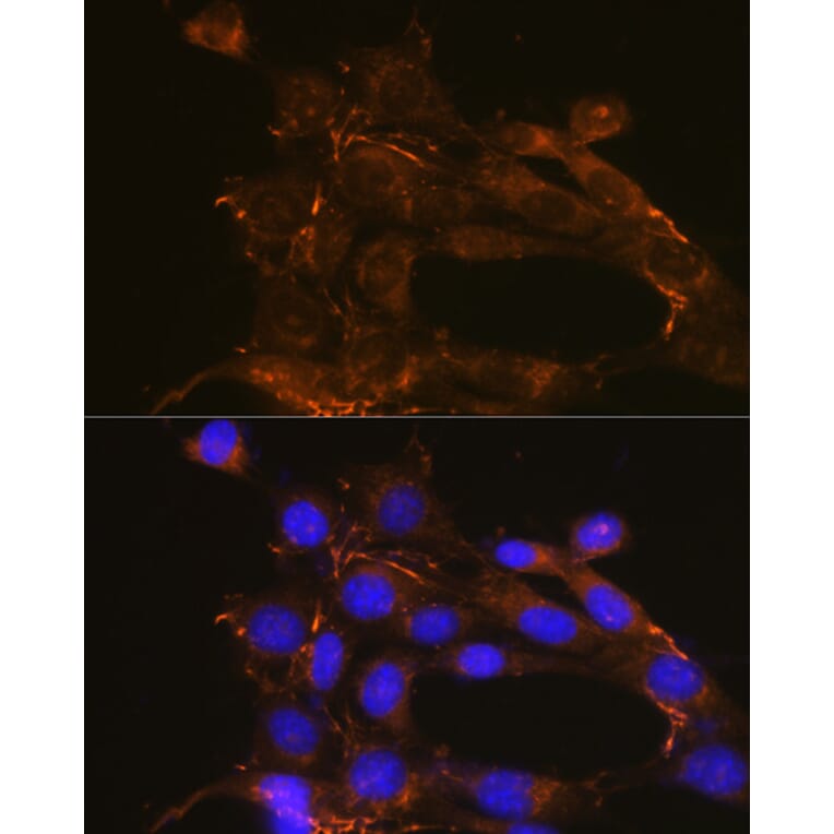 Immunofluorescence - Anti-Fibronectin Antibody (A89093) - Antibodies.com
