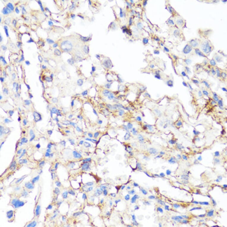 Immunohistochemistry - Anti-Fibronectin Antibody (A89094) - Antibodies.com
