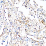 Immunohistochemistry - Anti-Fibronectin Antibody (A89094) - Antibodies.com