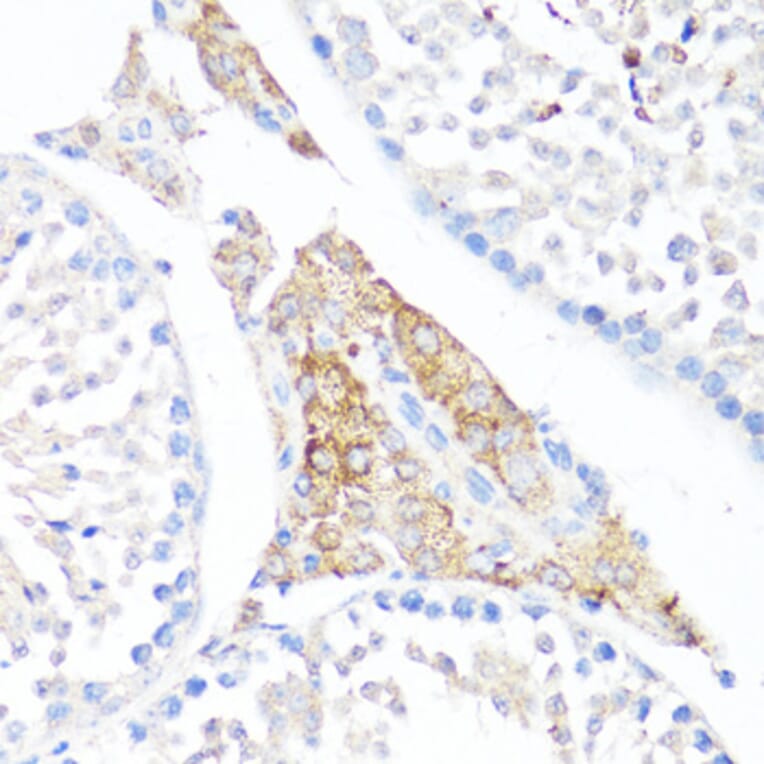 Immunohistochemistry - Anti-Fibronectin Antibody (A89094) - Antibodies.com
