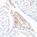 Immunohistochemistry - Anti-Fibronectin Antibody (A89094) - Antibodies.com