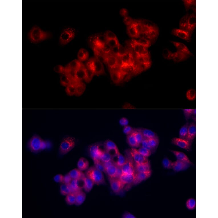 Immunofluorescence - Anti-Fibronectin Antibody (A89094) - Antibodies.com