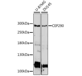 Western Blot - Anti-CEP290 Antibody (A89095) - Antibodies.com