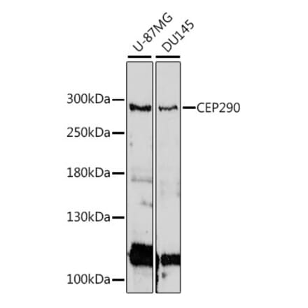 Western Blot - Anti-CEP290 Antibody (A89095) - Antibodies.com