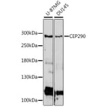 Western Blot - Anti-CEP290 Antibody (A89095) - Antibodies.com