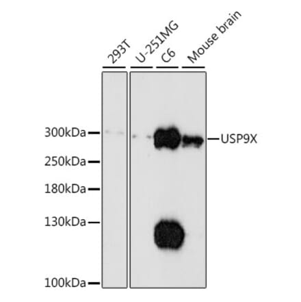 Western Blot - Anti-USP9x Antibody (A89096) - Antibodies.com