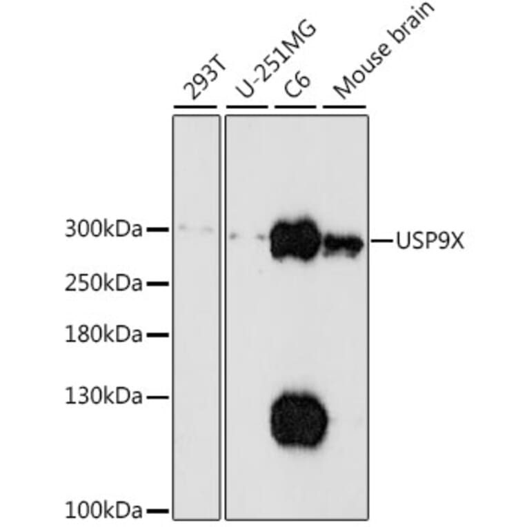 Western Blot - Anti-USP9x Antibody (A89096) - Antibodies.com