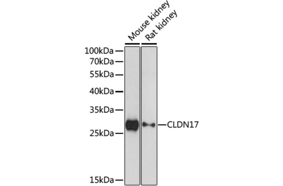 Western Blot - Anti-Claudin 17 Antibody (A89097) - Antibodies.com