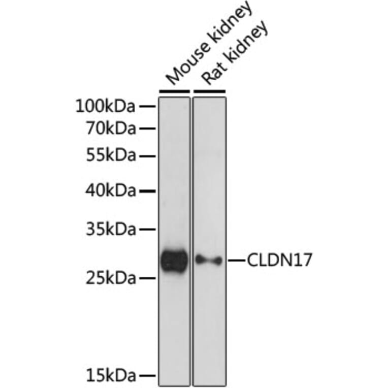Western Blot - Anti-Claudin 17 Antibody (A89097) - Antibodies.com