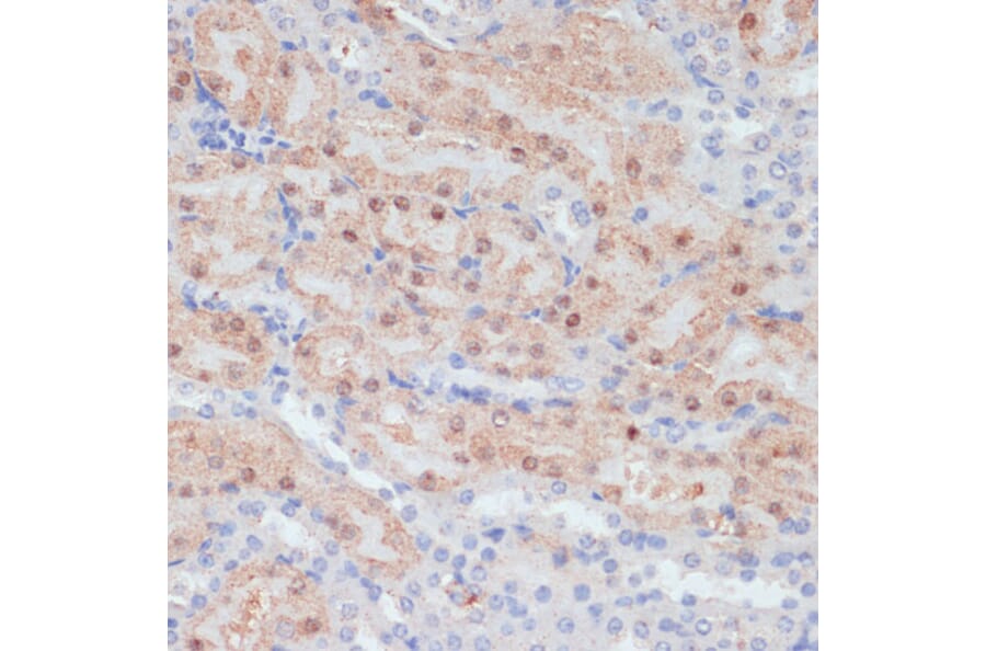 Immunohistochemistry - Anti-Claudin 17 Antibody (A89097) - Antibodies.com