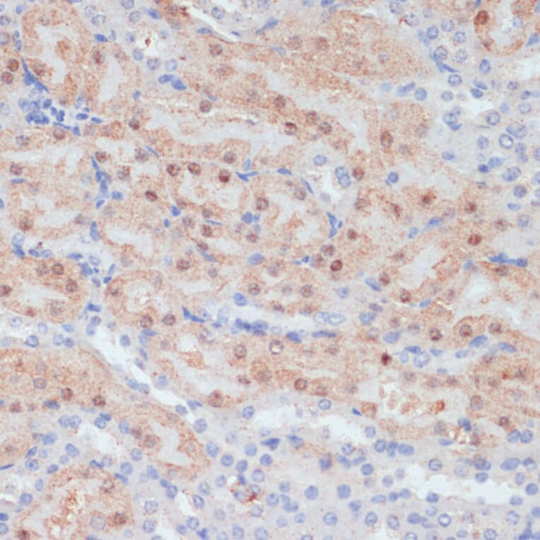 Immunohistochemistry - Anti-Claudin 17 Antibody (A89097) - Antibodies.com