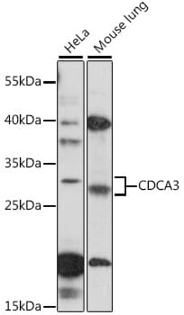 Western blot analysis of extracts of various cell lines, using Anti-CDCA3 Antibody (A16151) at 1:1,000 dilution.
Secondary antibody: Goat Anti-Rabbit IgG (H+L) (HRP) (AS014) at 1:10,000 dilution.
Lysates / proteins: 25µg per lane.
Blocking buffer: 3% non-fat dry milk in TBST.
Detection: ECL Basic Kit (RM00020).
Exposure time: 2min.