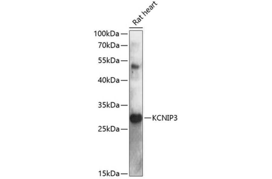 Western Blot - Anti-DREAM Antibody (A89099) - Antibodies.com