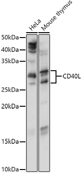 Western blot analysis of extracts of K561 cells, using Anti-CD40LG Antibody (A13002) at 1:1,000 dilution.
Secondary antibody: Goat Anti-Rabbit IgG (H+L) (HRP) (AS014) at 1:10,000 dilution.
Lysates / proteins: 25µg per lane.
Blocking buffer: 3% non-fat dry milk in TBST.
Detection: ECL Basic Kit (RM00020).
Exposure time: 60s.