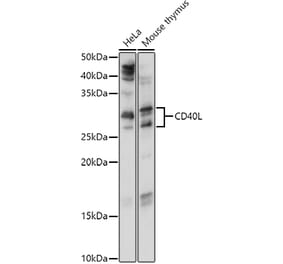 Western Blot - Anti-TNFSF5 Antibody (A89100) - Antibodies.com