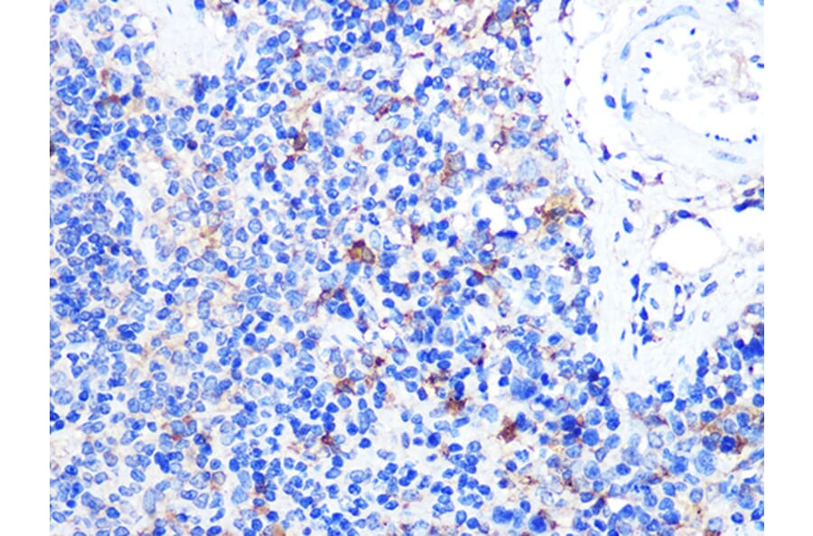 Immunohistochemistry - Anti-TNFSF5 Antibody (A89100) - Antibodies.com