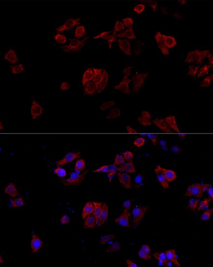 Immunofluorescence analysis of NIH/3T3 cells using Anti-CD40LG Antibody (A13002) at dilution of 1:100. Blue: DAPI for nuclear staining.