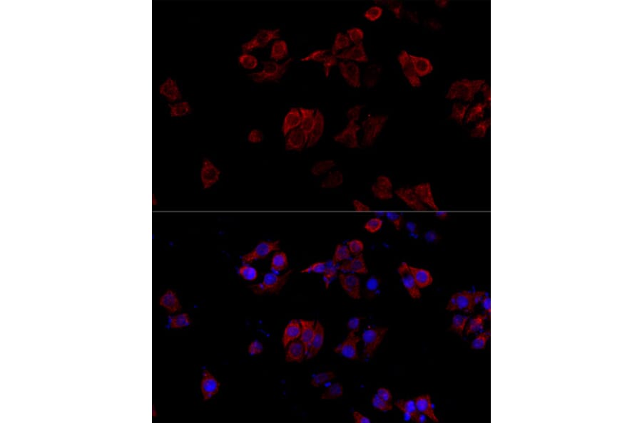 Immunofluorescence - Anti-TNFSF5 Antibody (A89100) - Antibodies.com