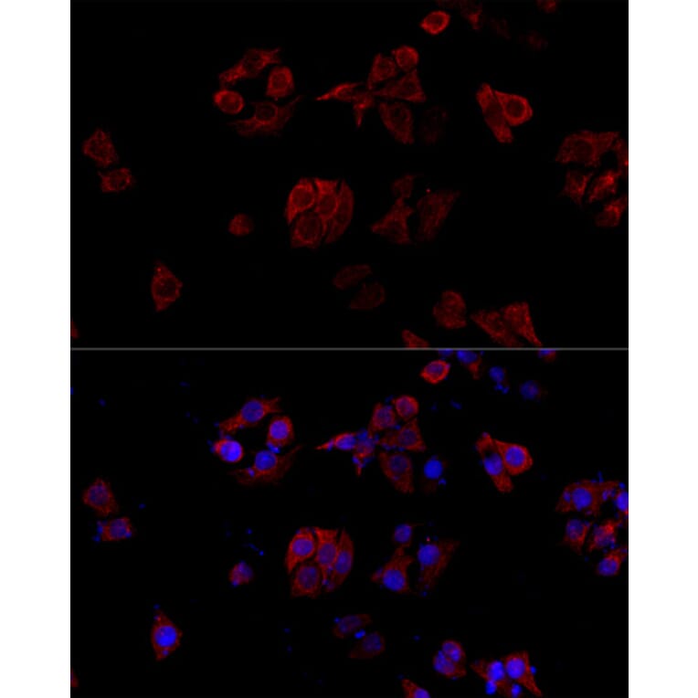 Immunofluorescence - Anti-TNFSF5 Antibody (A89100) - Antibodies.com
