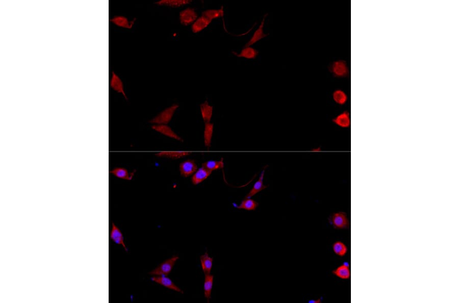 Immunofluorescence - Anti-TNFSF5 Antibody (A89100) - Antibodies.com