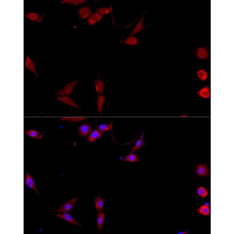 Immunofluorescence - Anti-TNFSF5 Antibody (A89100) - Antibodies.com