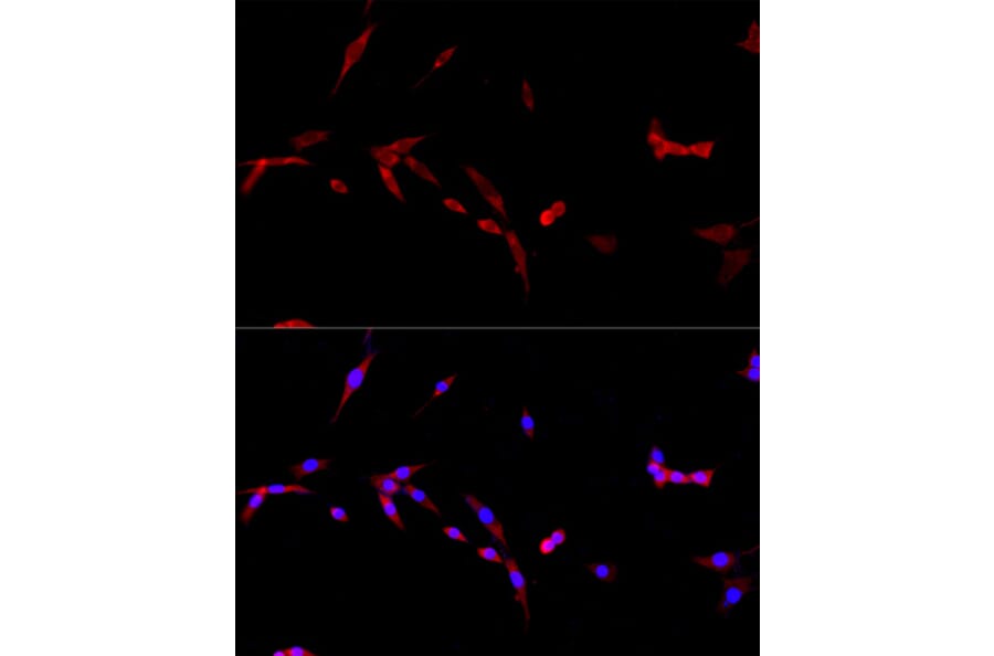 Immunofluorescence - Anti-TNFSF5 Antibody (A89100) - Antibodies.com